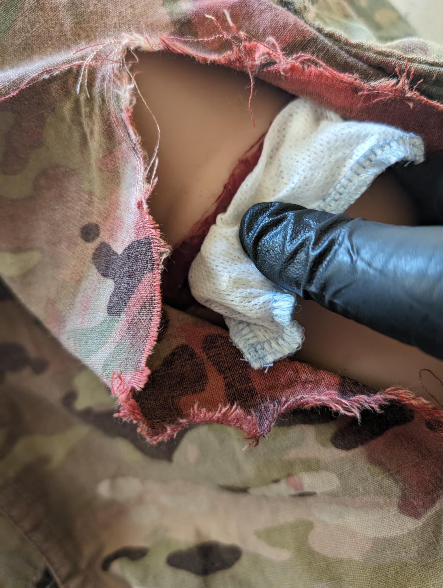 XGAUZE Trauma Pad, OTC Hemostatic Dressing – RevMedX
